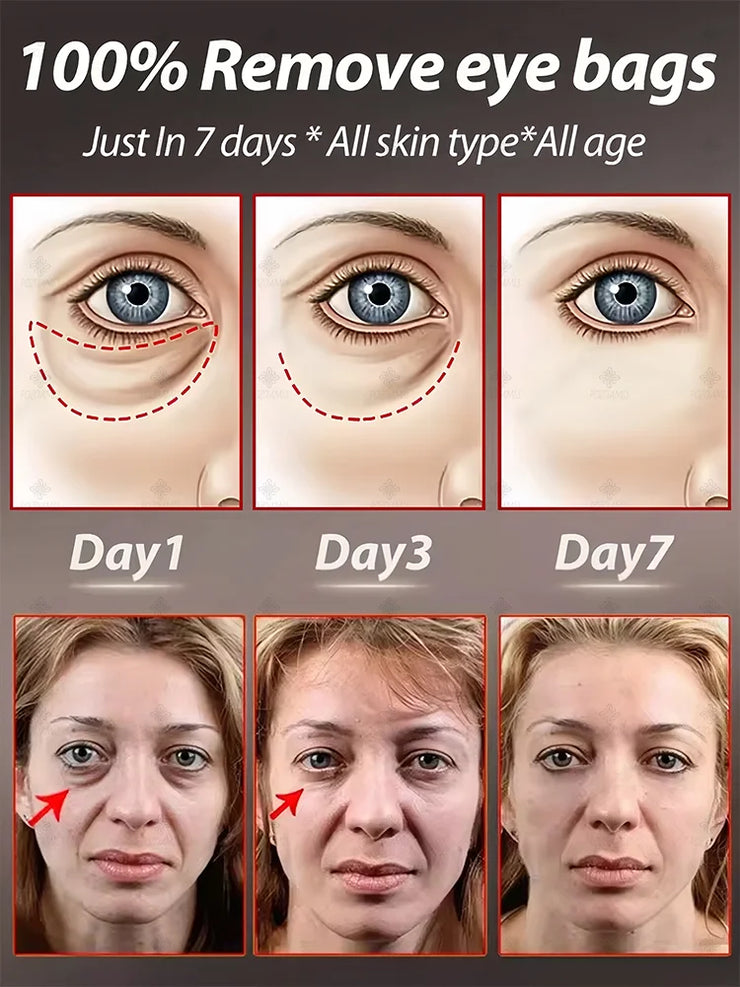 The best products of 2025,ᴵⁿˢᵗᵃⁿᵗˡʸ ʳᵉᵐᵒᵛᵉ ᵉʸᵉ ᵇᵃᵍˢ⸴ ʳᵉᵈᵘᶜᵉ ᶠⁱⁿᵉ ˡⁱⁿᵉˢ⸴ ᵗⁱᵍʰᵗᵉⁿ ˢᵏⁱⁿ⸴ ᶠⁱᵍʰᵗ ᵈᵃʳᵏ ᶜⁱʳᶜˡᵉˢ⸴