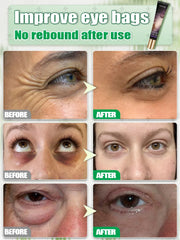 The best products of 2025,ᴵⁿˢᵗᵃⁿᵗˡʸ ʳᵉᵐᵒᵛᵉ ᵉʸᵉ ᵇᵃᵍˢ⸴ ʳᵉᵈᵘᶜᵉ ᶠⁱⁿᵉ ˡⁱⁿᵉˢ⸴ ᵗⁱᵍʰᵗᵉⁿ ˢᵏⁱⁿ⸴ ᶠⁱᵍʰᵗ ᵈᵃʳᵏ ᶜⁱʳᶜˡᵉˢ⸴